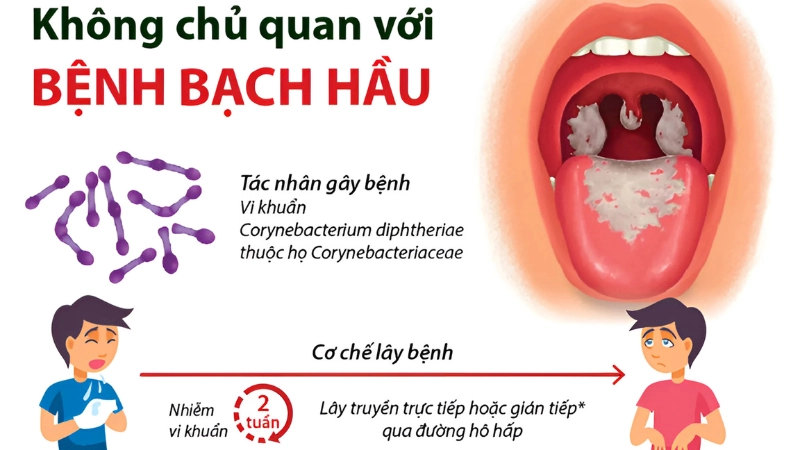Bệnh bạch hầu là gì?