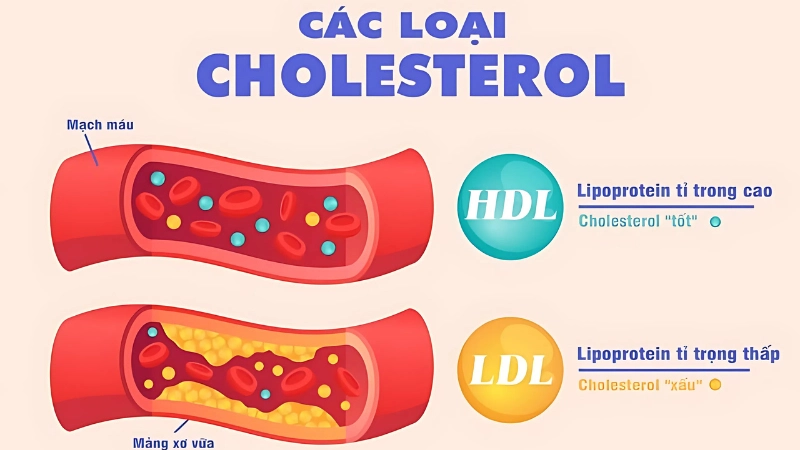 Cholesterol cao là gì và có nguy hiểm không?
