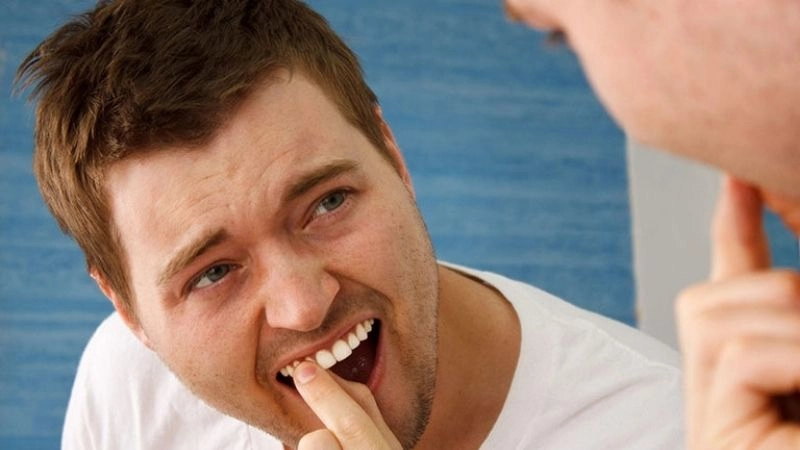 Nguyên nhân dẫn đến răng ê buốt phổ biến nhất
