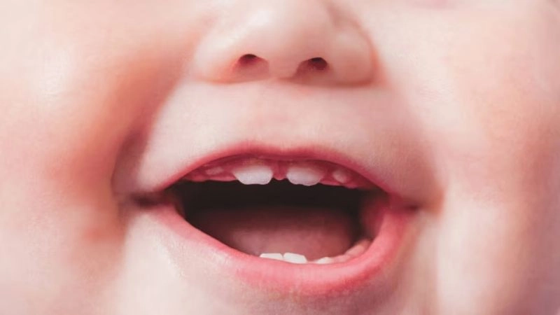 Nguyên nhân dẫn đến chậm mọc răng ở trẻ nhỏ