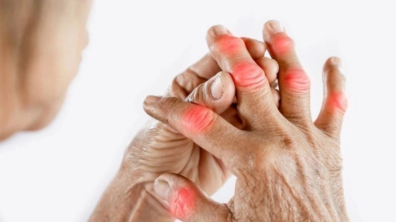 Nguyên nhân dẫn đến phong thấp thường gặp