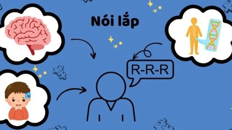 Nguyên nhân dẫn đến nói lắp phổ biến hiện nay