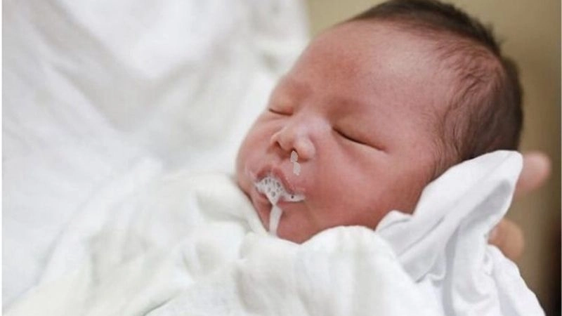 Nguyên nhân dẫn đến ọc sữa thường gặp ở trẻ