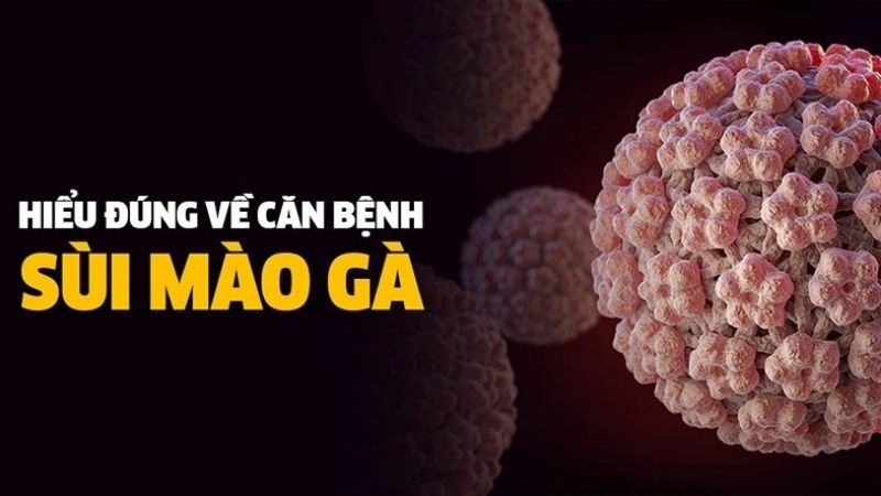 Virus HPV gây bệnh sùi mào gà