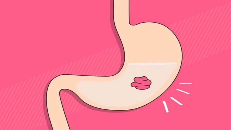 Giải mã chuyện nuốt singum có nguy hiểm không