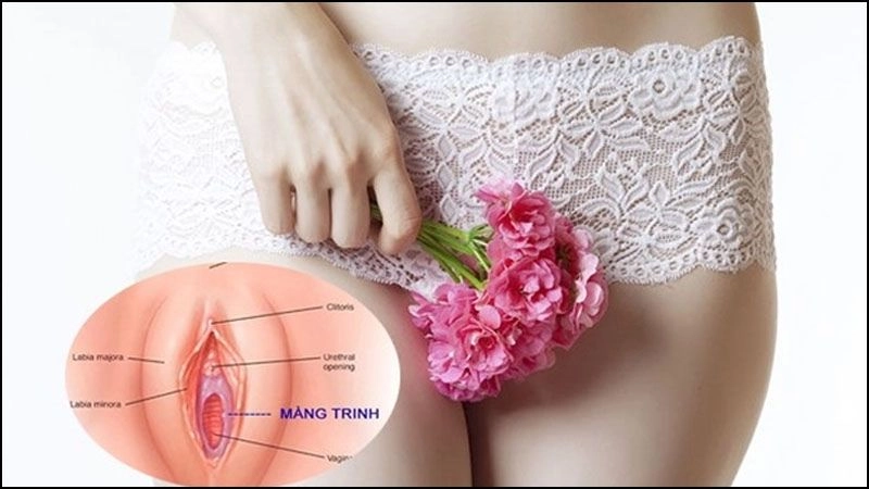 Màng trinh còn được gọi là màng ngăn âm đạo là một màng mỏng