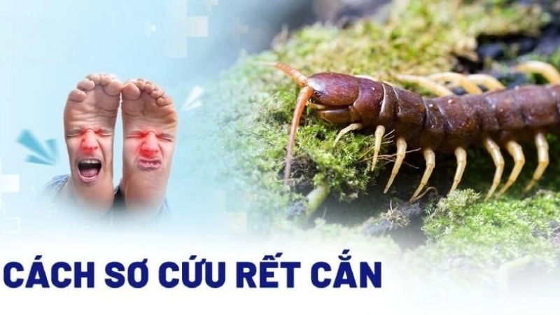 Làm gì khi bị rết nhỏ cắn để an toàn hơn