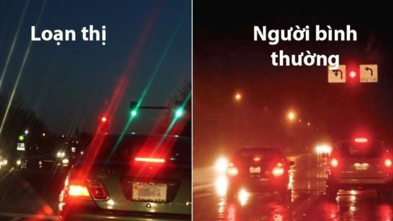 Loạn thị (Astigmatism) là tật khúc xạ ở mắt do giác mạc