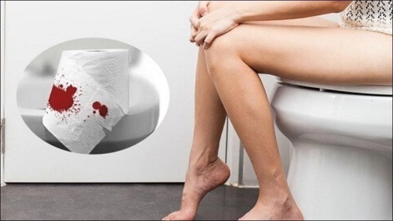 Nguyên nhân dẫn đến chảy máu hậu môn