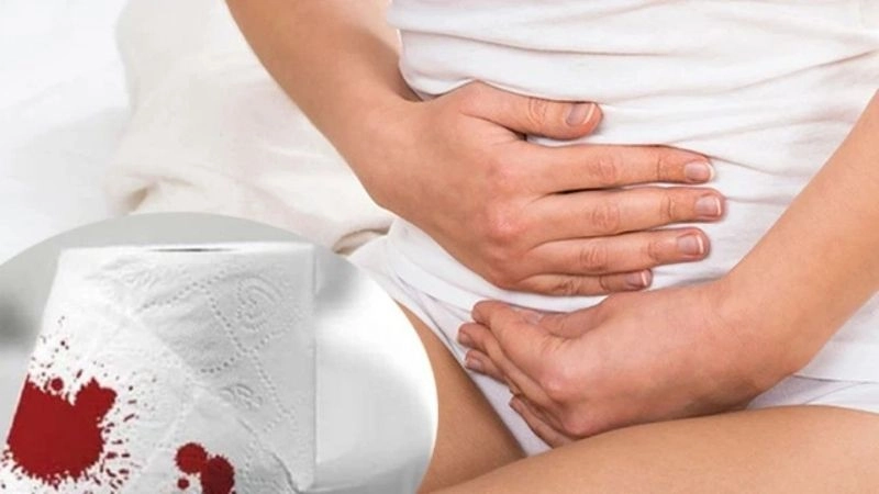 Làm gì khi bị chảy máu hậu môn nhẹ hay liên tục