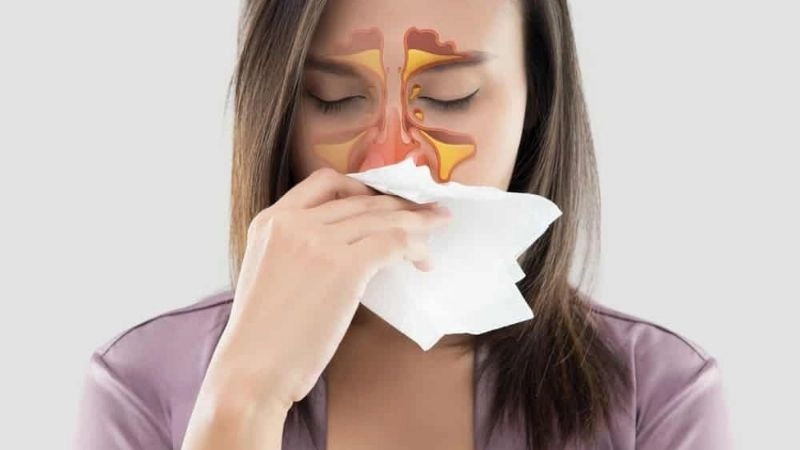Làm gì khi bị viêm xoang kéo dài liên tục