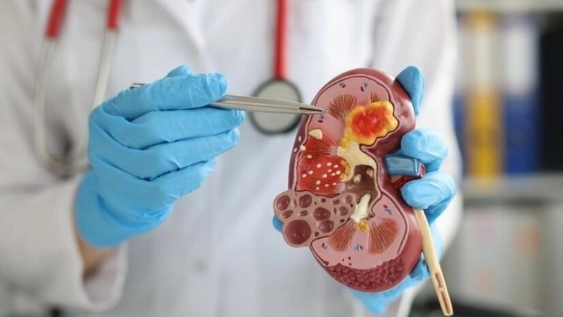 Yêu cầu để tham gia hiến thận an toàn 