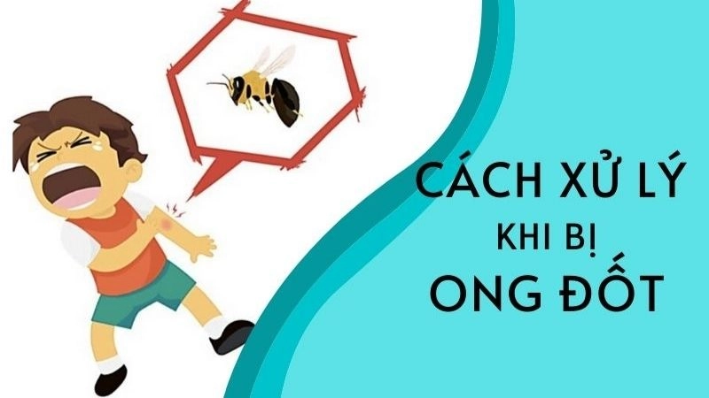 Các bước sơ cứu khi bị ong vàng đốt