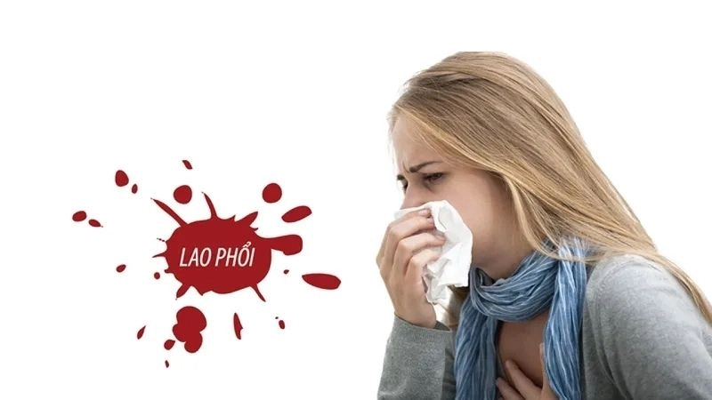 Cách cải thiện tình trạng lao phổi hiện nay
