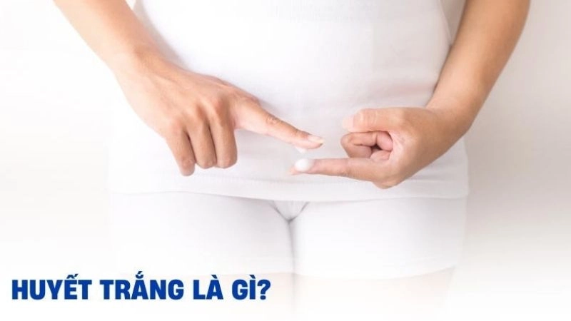 Huyết trắng là hiện tượng thường gặp ở phụ nữ