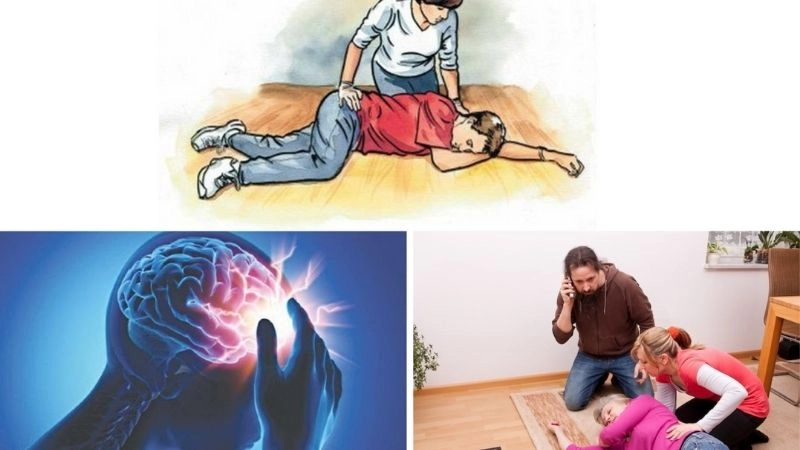 Các yếu tố dẫn đến đột quỵ không chỉ đến từ bệnh lý nền