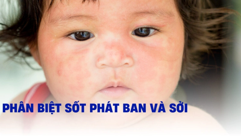 Đặc điểm nguyên nhân và tác nhân gây bệnh