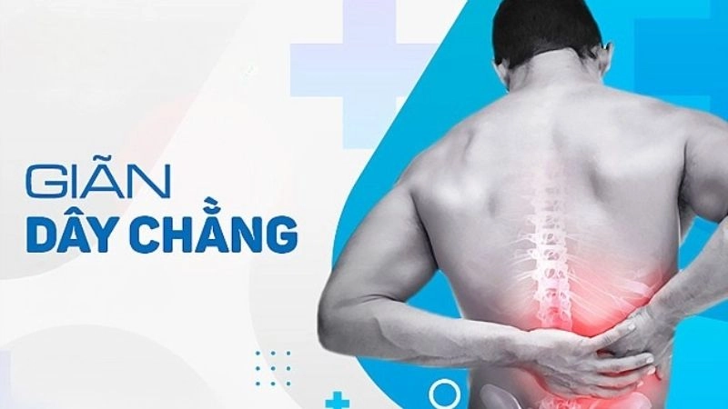 Giãn dây chằng là tình trạng dây chằng bị căng, kéo giãn quá mức nhưng không đứt