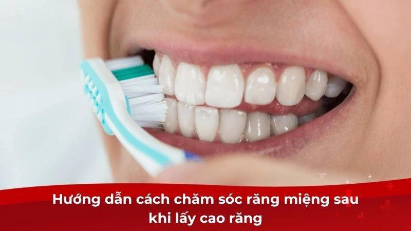 Tác hại của việc lấy cao răng sai cách ảnh hưởng lâu dài
