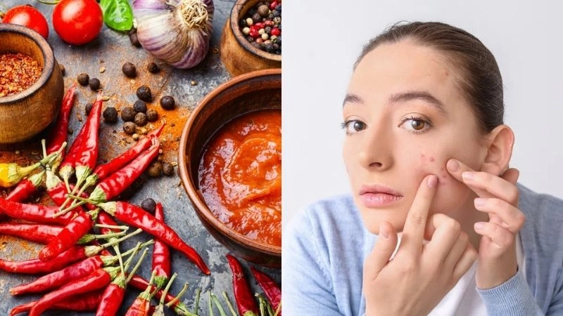 Tác hại của ăn cay quá mức khiến cơ thể mất cân bằng