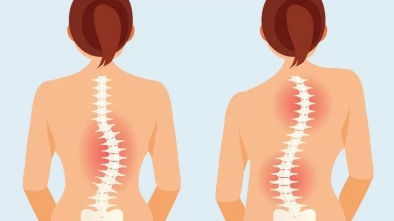 Tác hại của bàn chân bẹt ảnh hưởng cuộc sống