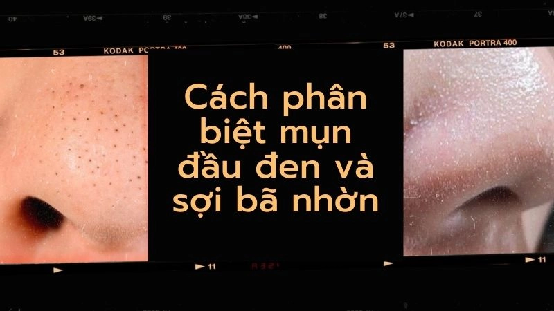 Bản chất sinh lý khác biệt của từng loại