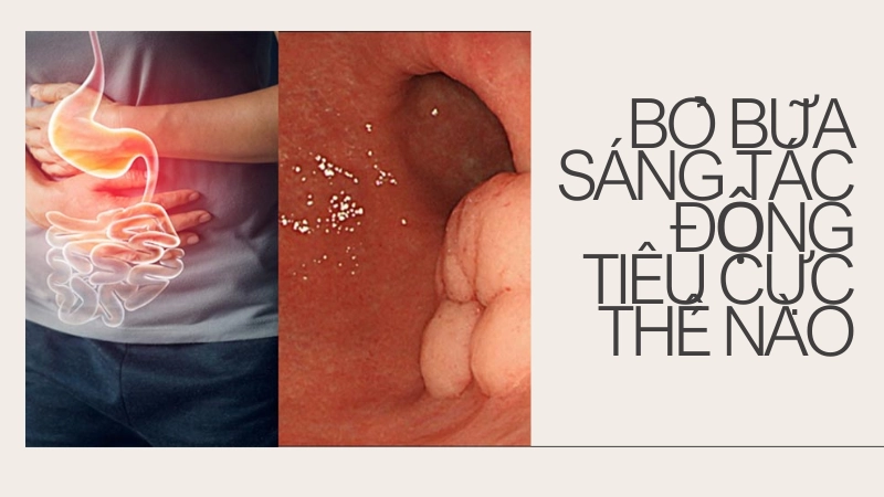 Hình ảnh mô phỏng dạ dày bị tổn thương do nhịn ăn sáng