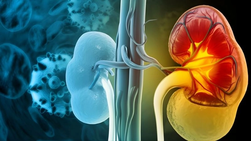 Tổn thương thận và chức năng lọc máu suy giảm