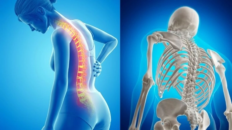 Ảnh hưởng xấu đến xương và nguy cơ loãng xương