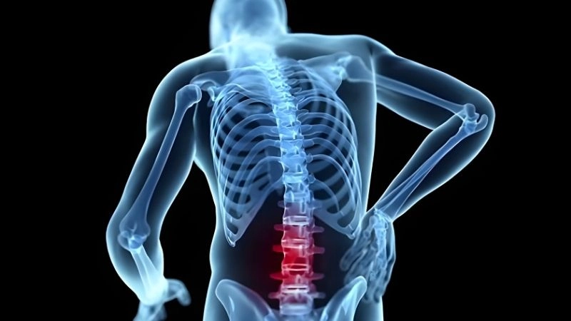 Cột sống và khung xương bị tàn phá nặng nề